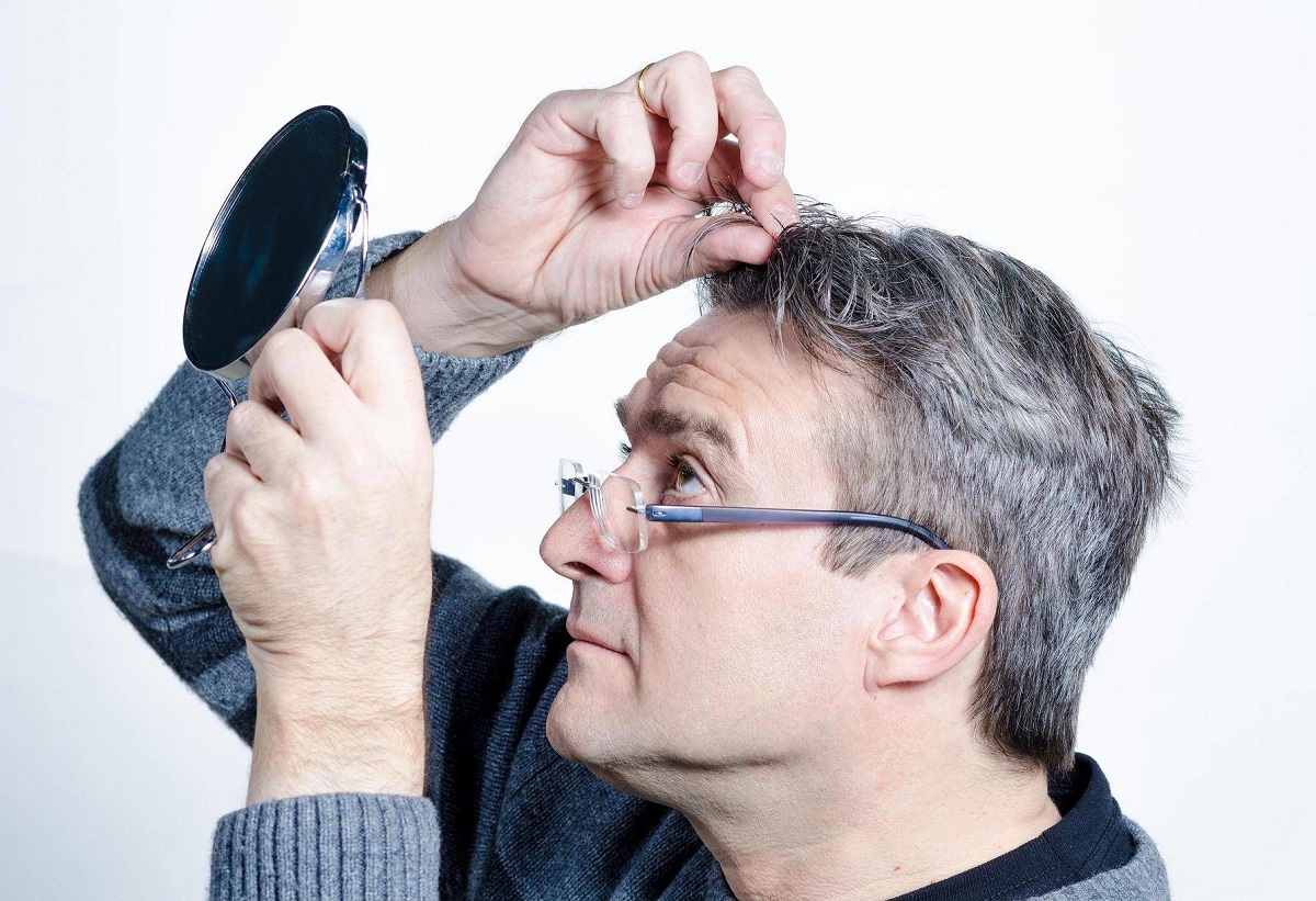 راه های جلوگیری از سفید شدن مو