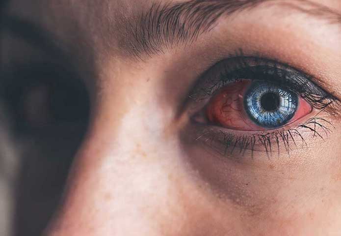 عوارض لوازم آرایش فیک برای پوست صورت عوارض لوازم آرایش فیک برای پوست صورت