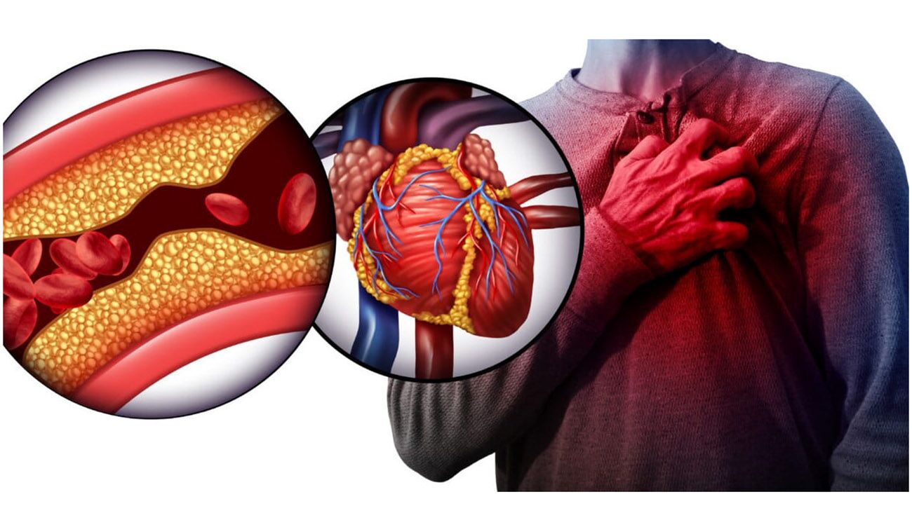 علائم کلسترول بالا و پایین در بدن انسان چیست؟