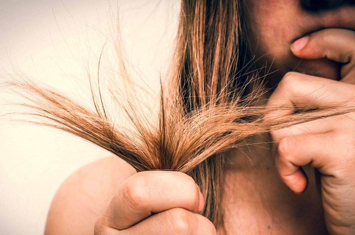 راههای درمان موخوره راههای درمان موخوره