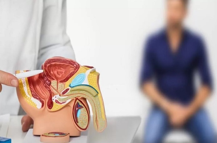 عوامل بروز سرطان پروستات عوامل بروز سرطان پروستات