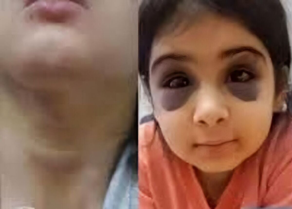 آزار و اذیت دختر