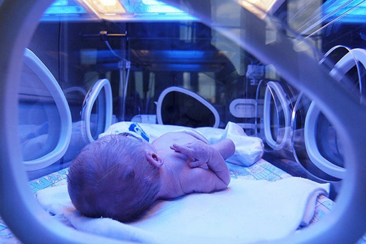 پاسخ به چند سوال درباره درمان زردی نوزادان