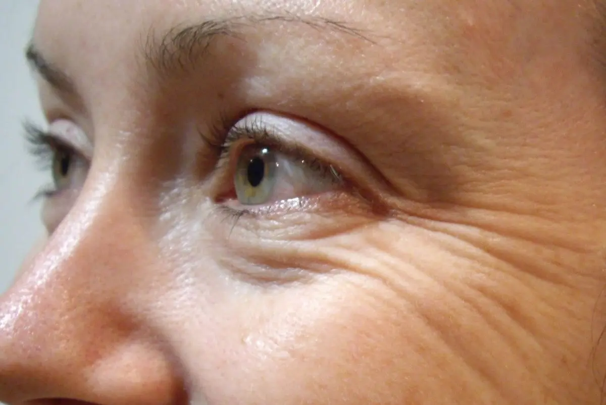 راز چینیها برای از بین بردن چروک راز چینیها برای از بین بردن چروک