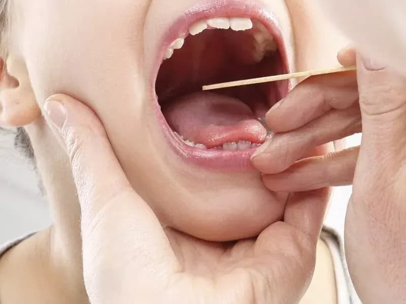 چه زمانی نیاز به جراحی لوزه داریم؟