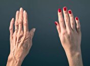 بهترین روش‌ها برای مقابله و جلوگیری از چروک شدن پوست دست