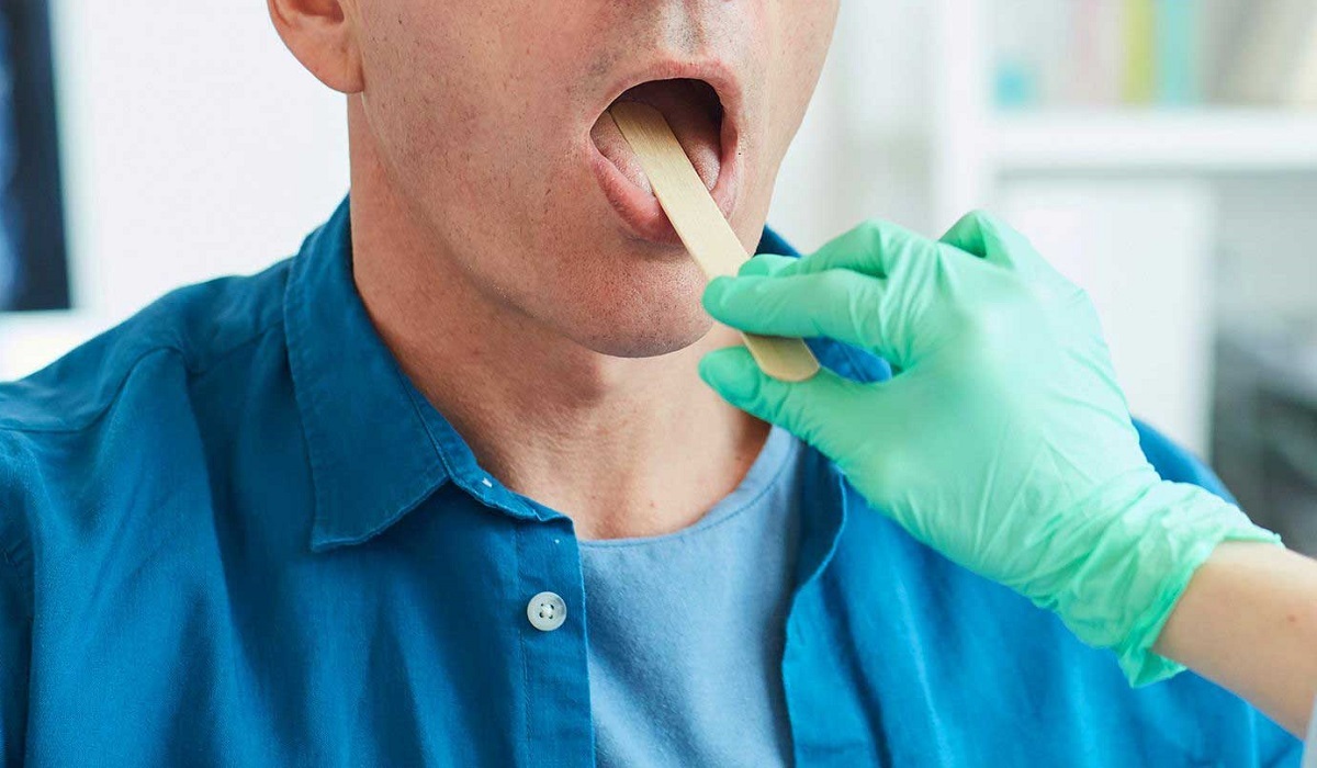 علائم ابتلا به سرطان دهان