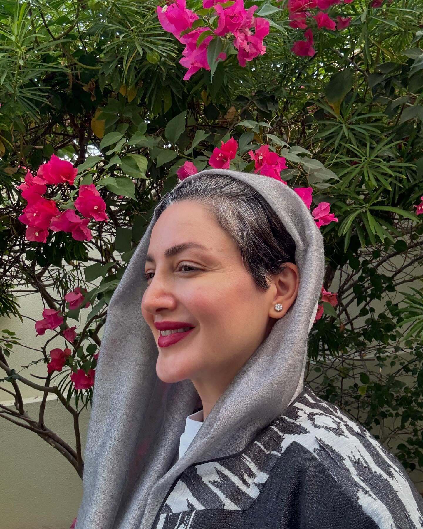 شیلا خداداد یک شبه پیر شد! + عکس