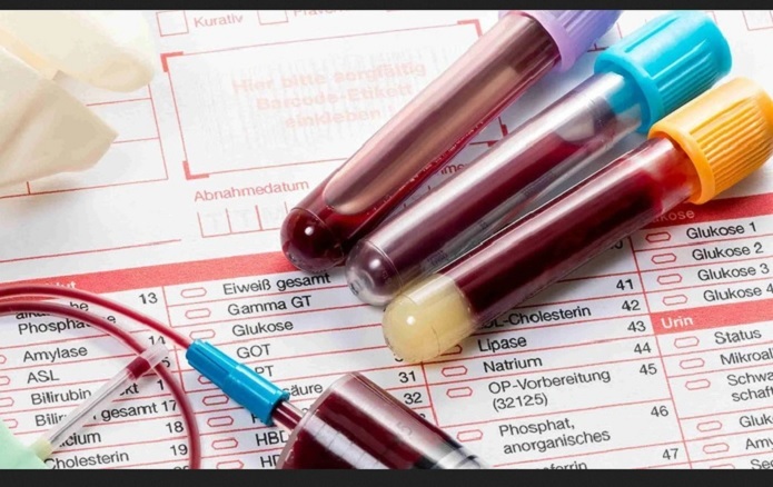 معانی علائم اختصاری برگه آزمایش خون