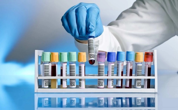 معانی علائم اختصاری برگه آزمایش خون