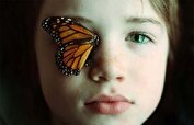 همه آنچه باید درباره بیماری EB یا پروانه ای بدانیم