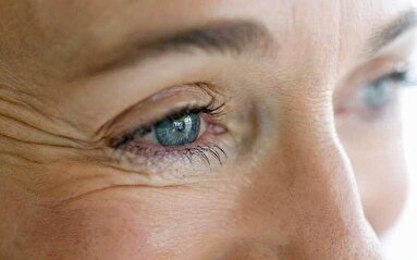 روش‌های طبیعی برای کاهش چین‌ و چروک صورت