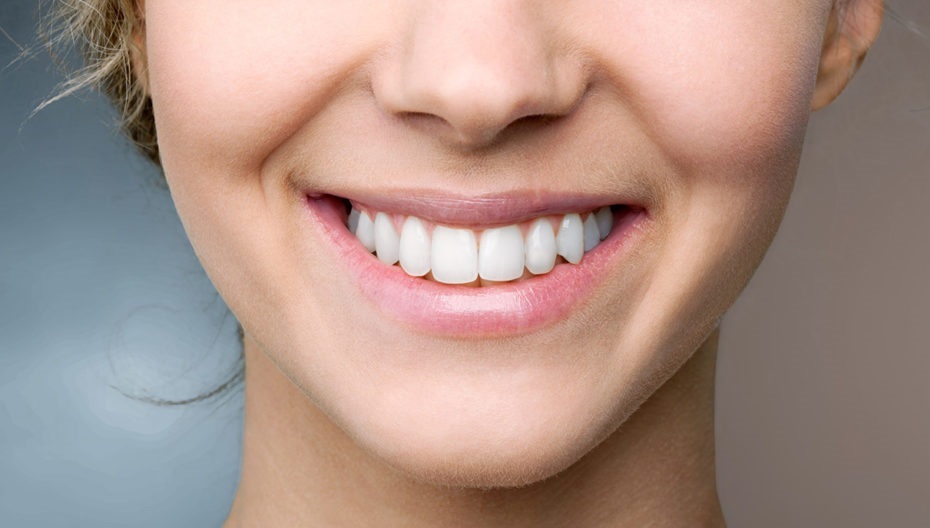 راههای سفید کردن دندان راههای سفید کردن دندان
